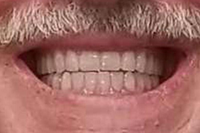 After
