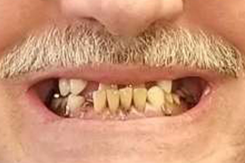 Before